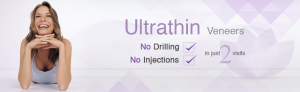 Ultrathin Dental Veneers